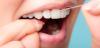Ağız ve Diş Temizliği